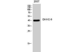 Western Blotting (WB) image for anti-Zinc Finger, DHHC-Type Containing 9 (ZDHHC9) (C-Term) antibody (ABIN3174756) (ZDHHC9 anticorps  (C-Term))