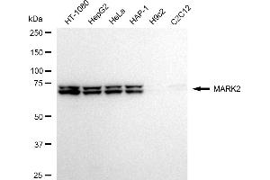 Western blotting analysis using MARK2 antibody (ABIN7799333).