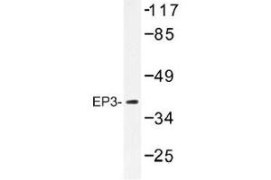 Image no. 1 for anti-Prostaglandin E Receptor 3 (Subtype EP3) (PTGER3) antibody (ABIN317859) (PTGER3 anticorps)