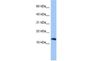 WB Suggested Anti-PTH2 Antibody Titration: 0. (Parathyroid Hormone 2 (PTH2) (Middle Region) anticorps)
