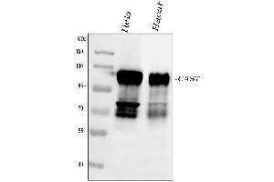 Western blot analysis of Calpastatin using anti-Calpastatin antibody (ABIN4886503). (Calpastatin anticorps  (Middle Region))
