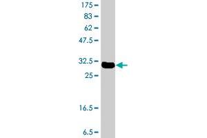 Western Blot detection against Immunogen (32.