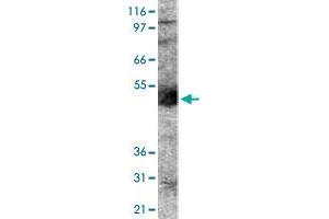 Western blot analysis of PODXL in human lung lysate using with PODXL polyclonal antibody . (PODXL anticorps  (AA 100-200))