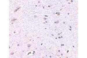 Immunohistochemistry of Syntaphilin in human brain with this product at 5 μg/ml.