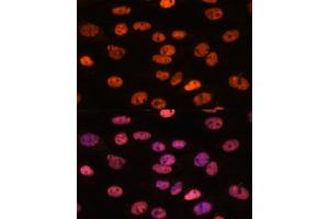Immunofluorescence analysis of C6 cells using MYEF2 antibody (ABIN7268721) at dilution of 1:100.