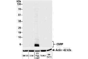 Western Blotting (WB) image for anti-Calcitonin-Related Polypeptide alpha (CALCA) (AA 75-125) antibody (ABIN7452578) (Recombinant CGRP anticorps  (AA 75-125))