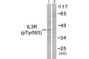 Western blot analysis of extracts from RAW264. (CSF2RB2 anticorps  (pTyr593))