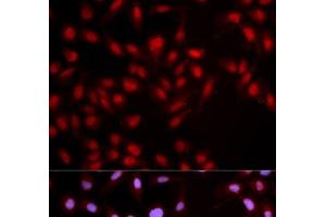 Immunofluorescence analysis of U2OS cells using Phospho-MET(Y1349) Polyclonal Antibody (c-MET anticorps  (pTyr1349))