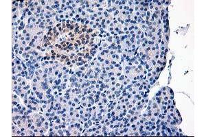 anti-Calpain 9 (CAPN9) antibody