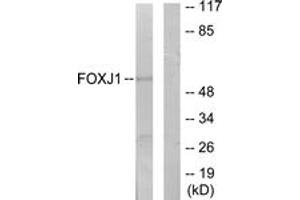 Western blot analysis of extracts from LOVO cells, using FOXJ1 Antibody. (FOXJ1 anticorps  (AA 271-320))