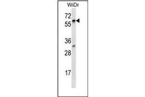 Western blot analysis of LARP7 Antibody (C-term) in WiDr cell line lysates (35ug/lane). (LARP7 anticorps  (C-Term))