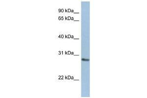 NANP antibody used at 1 ug/ml to detect target protein. (NANP anticorps  (Middle Region))