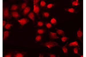 ABIN6267598 staining HeLa by IF/ICC.