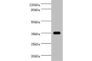 Western blot All lanes: SULT1C2 antibody at 5 μg/mL + Hela whole cell lysate Secondary Goat polyclonal to rabbit IgG at 1/10000 dilution Predicted band size: 35, 36 kDa Observed band size: 35 kDa (SULT1C2 anticorps  (AA 1-120))