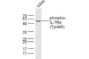 U2OS cell lysates probed with Rabbit Anti-IL-7Ra(Tyr449) Polyclonal Antibody, Unconjugated  at 1:500 for 90 min at 37˚C. (IKBKG anticorps  (pSer43))