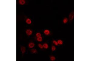 ABIN6266726 staining HT29 by IF/ICC.