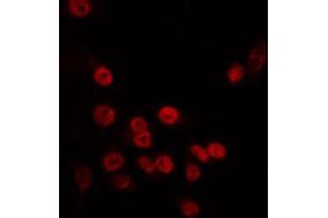 ABIN6266726 staining HT29 by IF/ICC. (TAF5L anticorps  (Internal Region))
