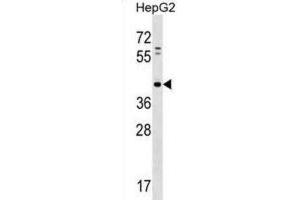 Western Blotting (WB) image for anti-Lipid Phosphate Phosphatase-Related Protein Type 5 (LPPR5) antibody (ABIN2998648) (LPPR5 anticorps)