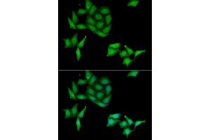 Immunofluorescence analysis of HeLa cell using CCNC antibody. (Cyclin C anticorps)