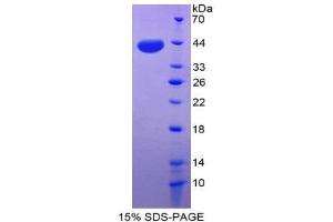 SDS-PAGE (SDS) image for Chemokine (C-X-C Motif) Ligand 3 (CXCL3) (AA 35-107) protein (His tag,GST tag) (ABIN1980968)
