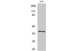 anti-Aldo-Keto Reductase Family 1, Member E2 (AKR1E2) (Internal Region) antibody