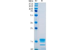 Human GITR Ligand Protein, His Tag on SDS-PAGE under reducing condition.