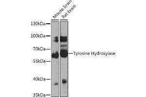 Western blot analysis of extracts of various cell lines, using Tyrosine Hydroxylase antibody (ABIN1683183, ABIN3015012, ABIN3015013 and ABIN6213590) at 1:1000 dilution. (Tyrosine Hydroxylase anticorps)