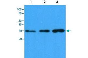 Western blot analysis of Lane 1: HeLa cell lysate, Lane 2: HepG2 cell lysate and Lane 3: 293T cell lysate with CBR1 monoclonal antibody, clone AT4E12  at 1:1000 dilution followed by HRP-conjugated goat anti-mouse secondary antibody and visualized by ECL detection system. (CBR1 anticorps)