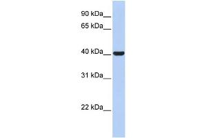 WB Suggested Anti-HSD3B1 Antibody Titration: 0. (HSD3B1 anticorps  (N-Term))