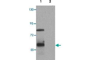 Western blot analysis of IRF4 in Jurkat cell lysate with IRF4 polyclonal antibody  at 1 ug/mL. (IRF4 anticorps  (C-Term))