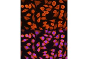 Immunofluorescence analysis of L929 cells using Cytokeratin 5 (Cytokeratin 5 (KRT5)) Rabbit pAb (ABIN3016404, ABIN3016405, ABIN3016406 and ABIN6219743) at dilution of 1:100.