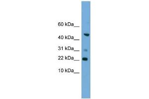 WB Suggested Anti-RAC1 Antibody Titration: 0.