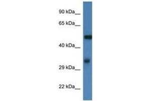 Image no. 1 for anti-Fascin (FSCN1) (AA 93-142) antibody (ABIN6746004) (Fascin anticorps  (AA 93-142))
