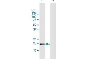 Western Blot analysis of CLEC3A expression in transfected 293T cell line by CLEC3A MaxPab polyclonal antibody. (CLEC3A anticorps  (AA 1-197))