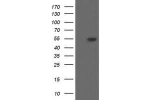 Western Blotting (WB) image for anti-Diphthamide Biosynthesis Protein 2 (DPH2) antibody (ABIN1497891) (DPH2 anticorps)