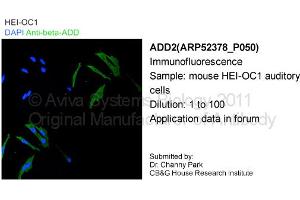 Image no. 2 for anti-Adducin 2 (Beta) (ADD2) (Middle Region) antibody (ABIN406210) (ADD2 anticorps  (Middle Region))
