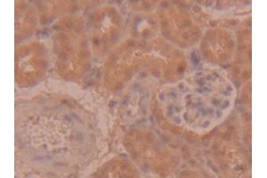 DAB staining on IHC-P; Samples: Mouse Kidney Tissue (PEDF anticorps  (AA 125-261))