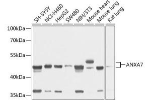 Western blot analysis of extracts of various cell lines, using  antibody (ABIN1678673, ABIN3018016, ABIN3018017 and ABIN6220336) at 1:1000 dilution. (Annexin VII anticorps  (AA 237-466))