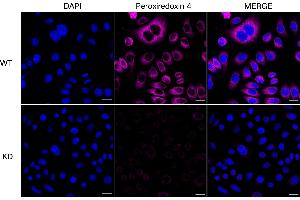 Immunocytochemical staining of HeLa cells using Peroxiredoxin 4 antibody (ABIN7799779), 1:1,000), Top panel: wild-type (WT), Bottom panal: Peroxiredoxin 4 shRNA knockdown (KD). (Recombinant Peroxiredoxin 4 anticorps)