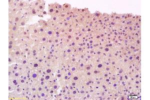 Formalin-fixed and paraffin embedded mouse liver tissue labeled with Anti-CYP27A1 Polyclonal Antibody, Unconjugated (ABIN708911) at 1:200 followed by conjugation to the secondary antibody and DAB staining