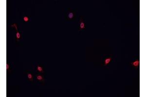 ABIN6266767 staining HeLa cells by IF/ICC. (ATRX anticorps  (N-Term))