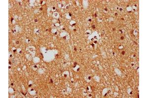 IHC image of ABIN7152731 diluted at 1:400 and staining in paraffin-embedded human brain tissue performed on a Leica BondTM system. (FEZF1 anticorps  (AA 1-115))