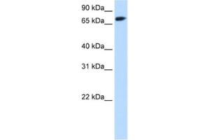 Western Blotting (WB) image for anti-Forkhead Box O1 (FOXO1) antibody (ABIN2463785) (FOXO1 anticorps)