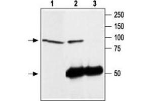 Immunoprecipitation of rat brain lysate: - 1. (TRPC4 anticorps  (C-Term, Intracellular))