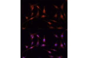 Immunofluorescence analysis of PC12 cells using FKBP5 antibody.