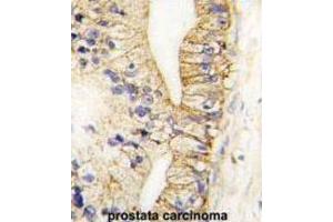 Immunohistochemistry (IHC) image for anti-Cadherin 7 (CDH7) antibody (ABIN2998181)