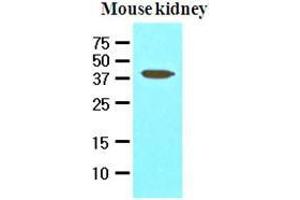 The extracts of mouse kidney (50 ug) were resolved by SDS-PAGE, transferred to nitrocellulose membrane and probed with anti-human PDCD12 (1:1000). (AVEN anticorps  (AA 254-362))