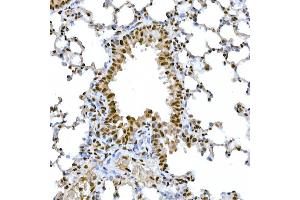 Immunohistochemistry of paraffin-embedded mouse lung using Snail Rabbit pAb (ABIN1682836, ABIN3019402, ABIN3019403, ABIN3019404 and ABIN6220883) at dilution of 1:150 (40x lens).