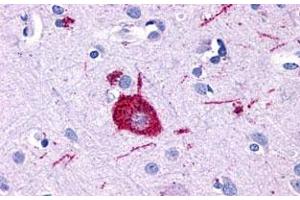 Immunohistochemistry (Formalin/PFA-fixed paraffin-embedded sections) of human brain, neuron with GPR116 polyclonal antibody . (G Protein-Coupled Receptor 116 anticorps  (3rd Cytoplasmic Domain))