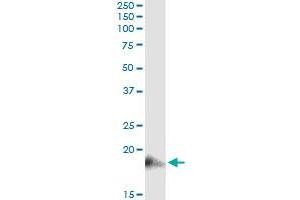 Immunoprecipitation of BST2 transfected lysate using anti-BST2 monoclonal antibody and Protein A Magnetic Bead , and immunoblotted with BST2 MaxPab rabbit polyclonal antibody.